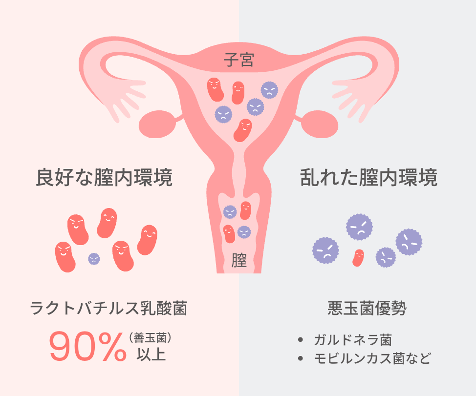 膣内フローラの善玉菌と悪玉菌のイメージ図